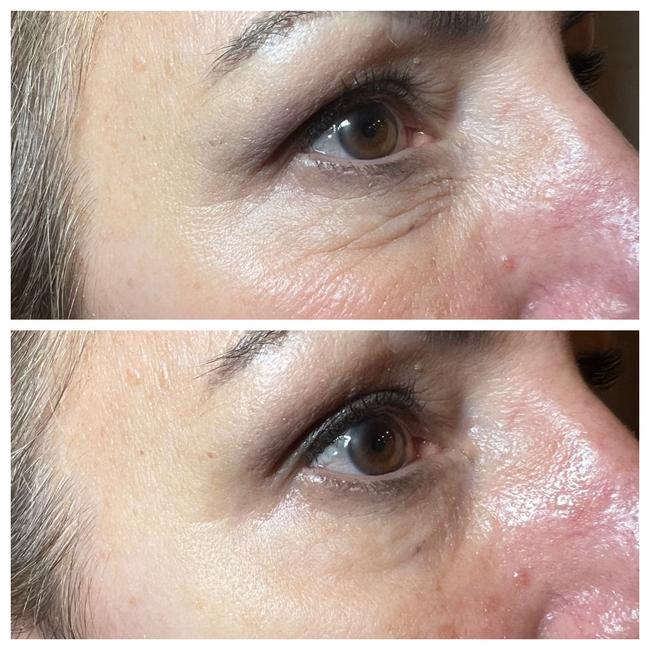 Instant Eye Lift (4 Treatments)-gallery-46572630376728