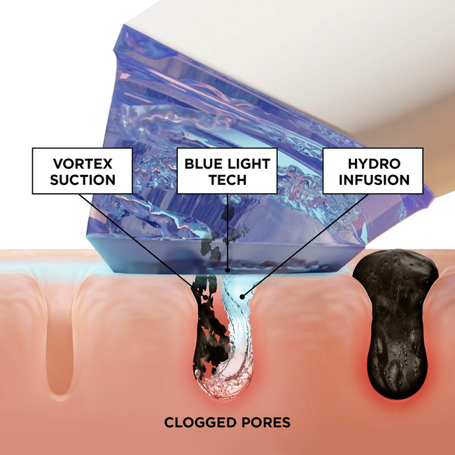 The GLOfacial Basic Set-gallery-33268827193537