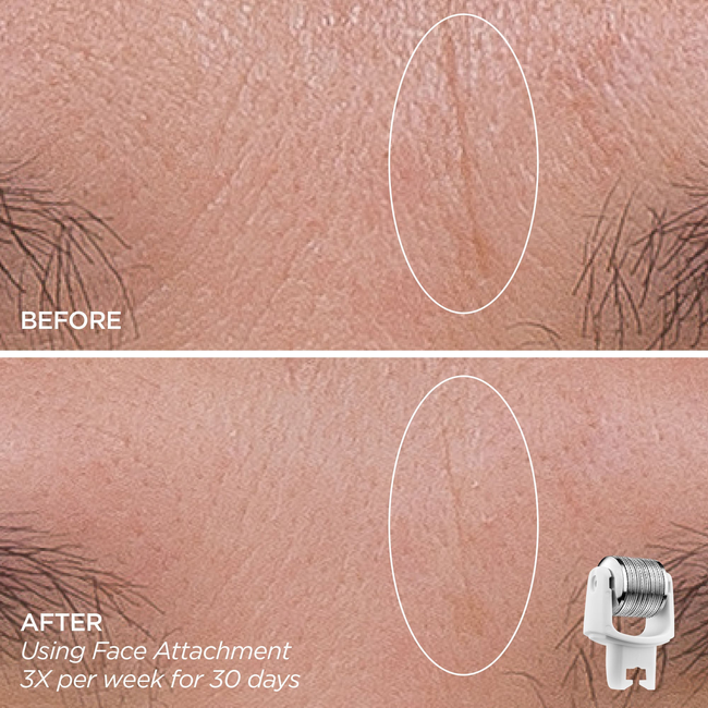 Eye Want It All-gallery-47501087572161