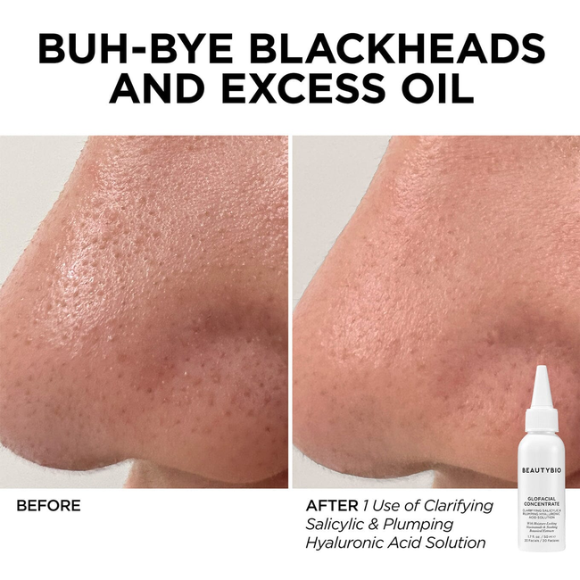 Golden Glow Hydration Facial-gallery-45864980316353