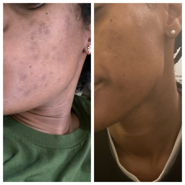 Dream Dew Vitamin A Serum-gallery-46572702368024