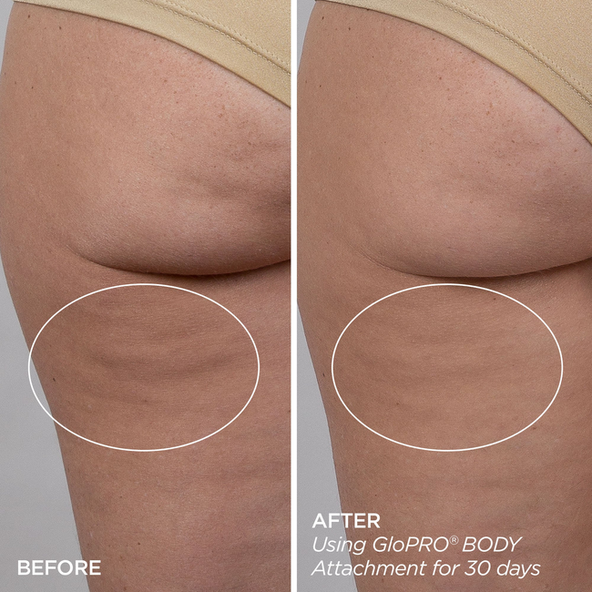 Sculpt & Smooth Body Bundle-gallery-48132300439745