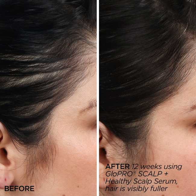 Rejuvenating Scalp + Fuller Hair Therapy Set-gallery-46611620430017