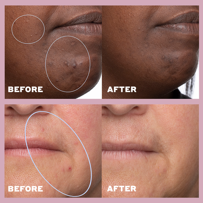 UPDATED Skin Rhythm B&A.png