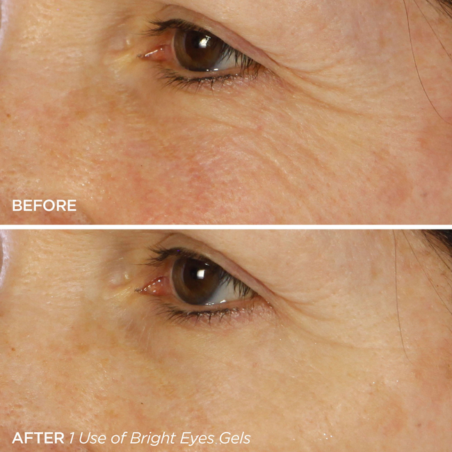 Bright Eyes-gallery-47238844743873