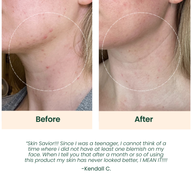 Clarifying Anti-Blemish Serum-gallery-49153675329809