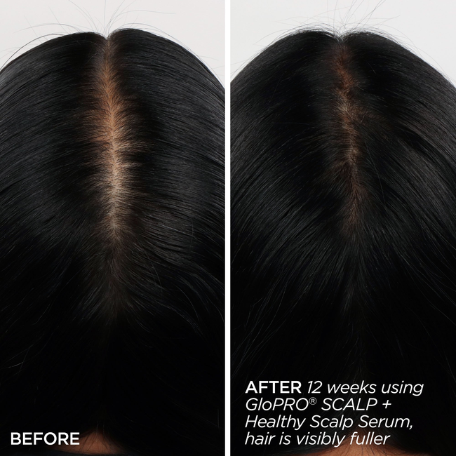 Rejuvenating Scalp + Fuller Hair Therapy Set-gallery-46611620561089