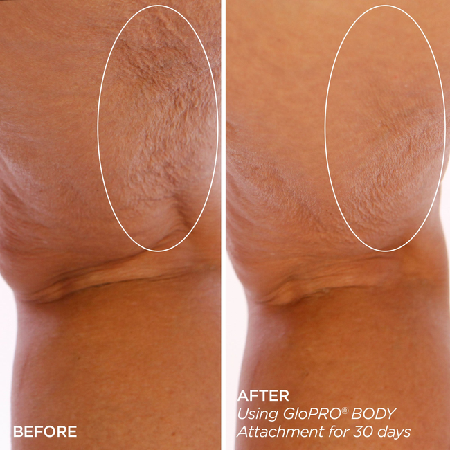 Sculpt & Smooth Body Bundle-gallery-48132300374209