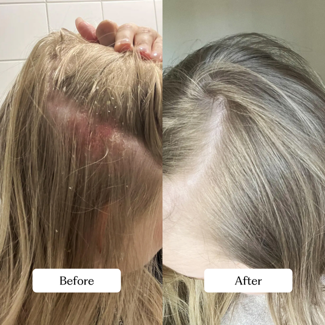 Soothing Scalp Treatment Kit-gallery-47070415159601
