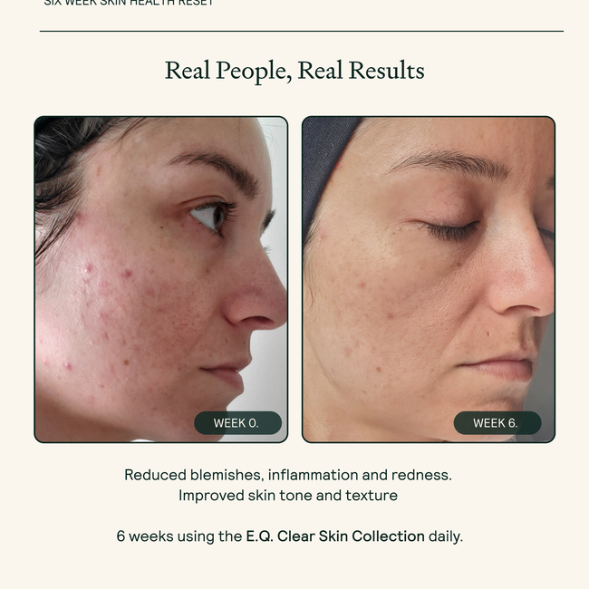 E.Q. Discovery Size Rescue Serum-gallery-33770191519809