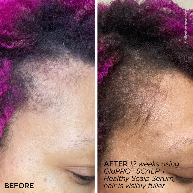 Rejuvenating Scalp + Fuller Hair Therapy Set-gallery-46611620593857