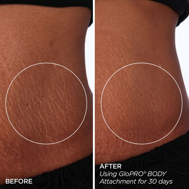 Sculpt & Smooth Body Bundle-gallery-48132300406977