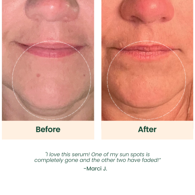 Brightening Vitamin C Serum-gallery-49153674477841