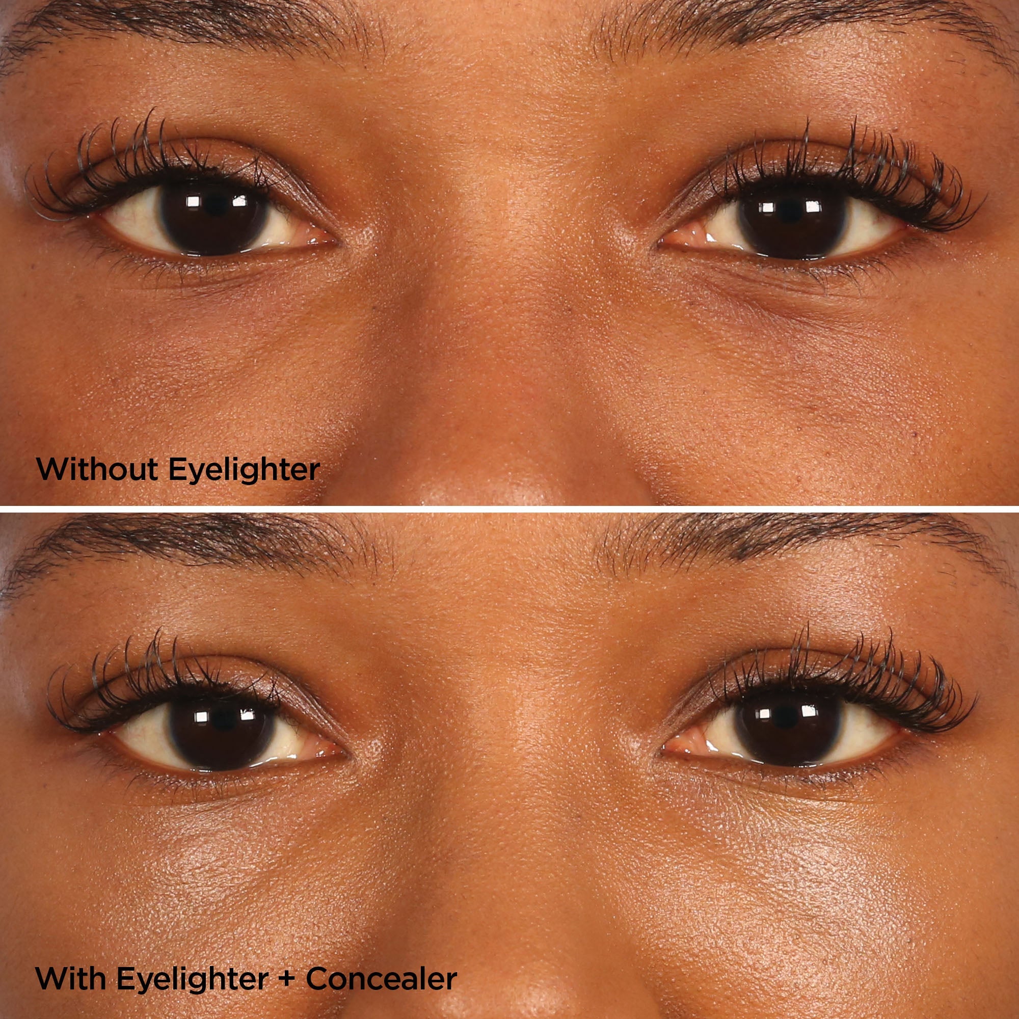 The Eyelighter Concentrate